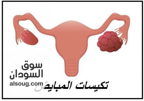 فتح الاشتراك والمتابعة لمعالجة مقاومة الأنسولين و تكيسات المبايض - صورة رقم 1