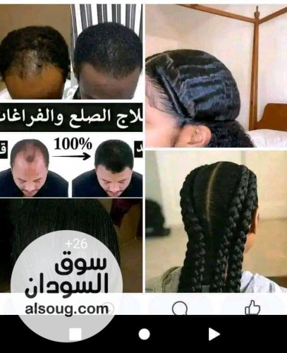 هوي ناس الجلحات وناس الما عندها دقن تعالو هنا وصل المنتج الناجح - صورة رقم 1
