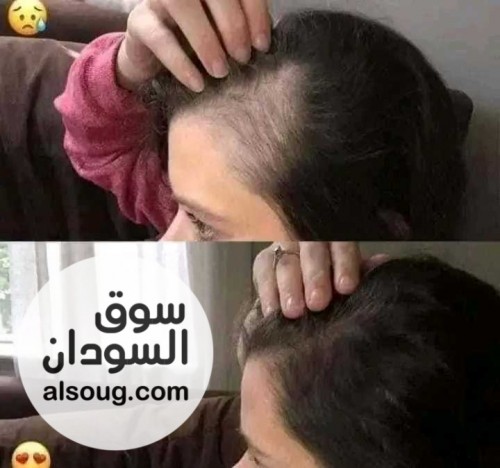 زيت جيكا Gika mix الاردني - صورة رقم 8