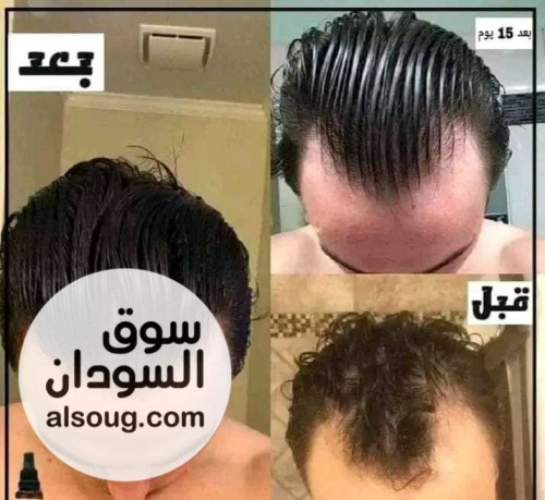 زيت جيكا Gika mix الاردني - صورة رقم 14