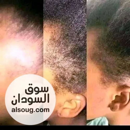 زيت جيكا Gika mix الاردني - صورة رقم 13