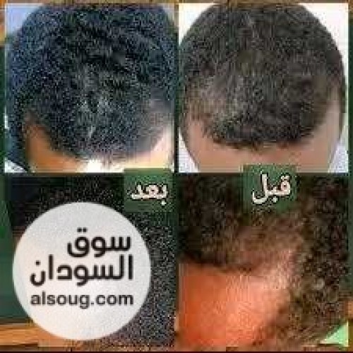زيت جيكا Gika mix الاردني - صورة رقم 5