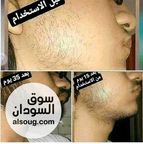 زيت اللحية الاصلي - صورة رقم 3