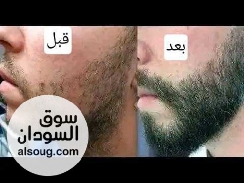زيت اللحية الاصلي - صورة رقم 4