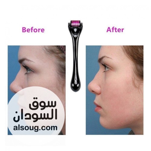 فوائد ديرما رولر للشعر derma roller للشعر - صورة رقم 1