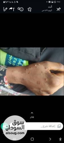 مقشر ومرطب امريكي اخيرا اتوفر في السودان - صورة رقم 6