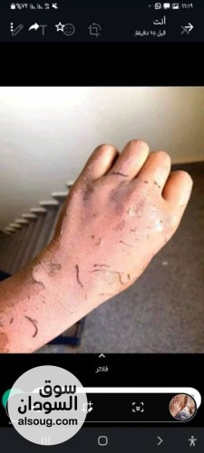 مقشر ومرطب امريكي اخيرا اتوفر في السودان - صورة رقم 5