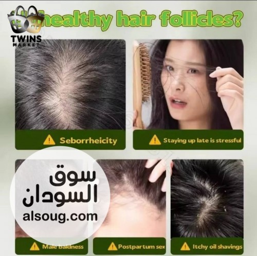 اتوفرت الصابونة الصينية الخضراء -لو شعرك بتساقط، خفيف، أو دايمًا - صورة رقم 4