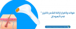 فوائد وأضرار إزالة الشعر بالليزر في السودان